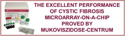 Reliable detection of the Cystic Fibrosis causing mutations